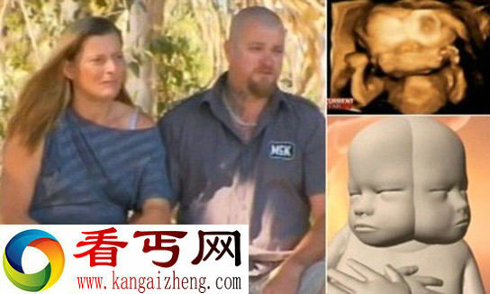 盘点那些让人心惊肉跳的怪胎