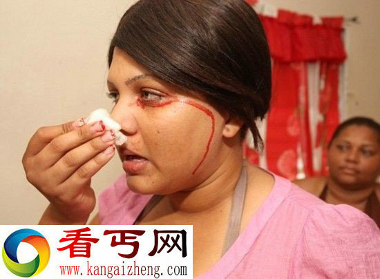 据英国《每日邮报》12月6日报道，来自多米尼加共和国贝龙的19岁女孩德尔菲娜·塞德尼奥(Delfa